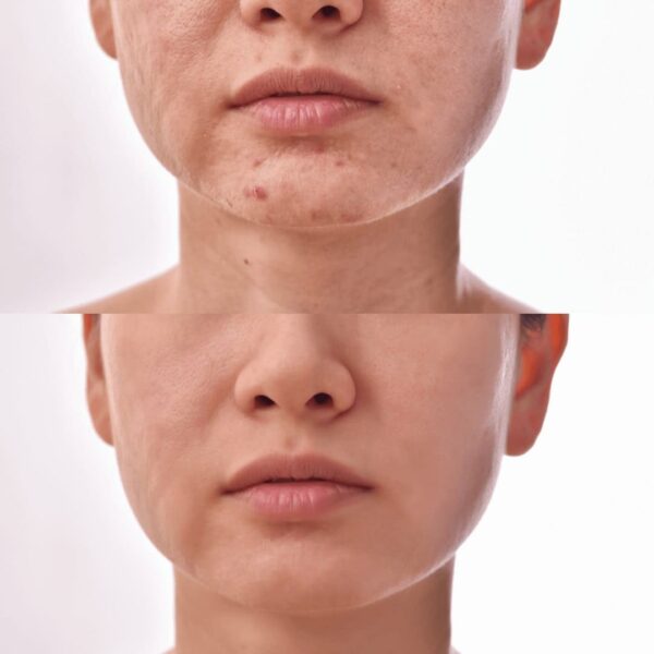 מברשת חשמלית לניקוי יסודי של עור הפנים 5 ב-1 (1)