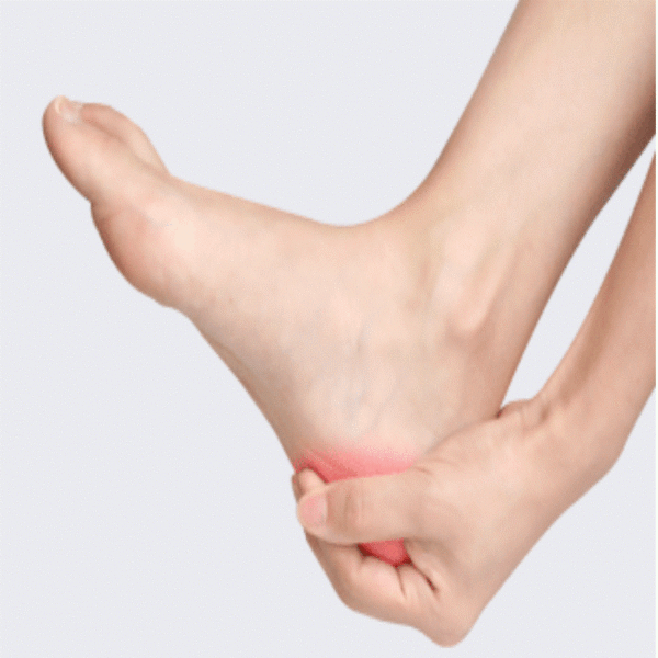 מגני סילקון למניעת כאב בעקב הרגל