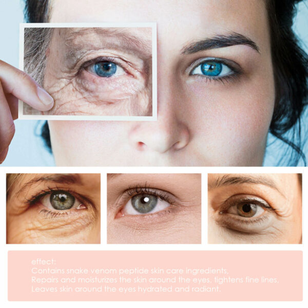 קרם עיניים טיפולי לטיפול בנפיחות וקמטים