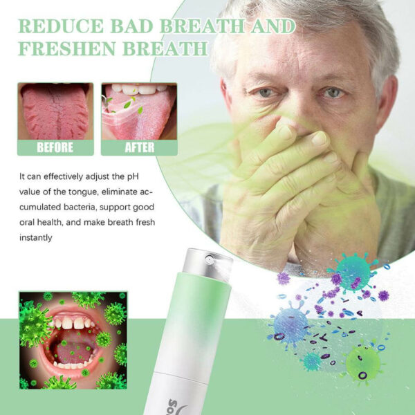 תרסיס לטיפול בריח רע מהפה ובעיות בלשון