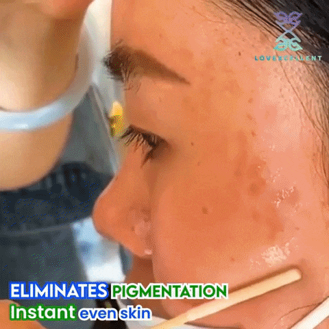 סרום לטיפול בפיגמנטציה וקמטים בעור הפנים