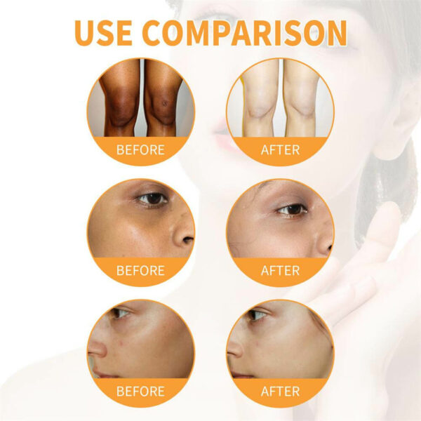 קרם פפאיה חדשני לטיפול ושיקום עור הפנים