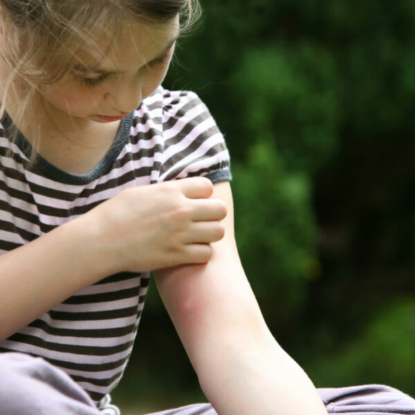מדבקות ילדים להרחקת יתושים וחרקים